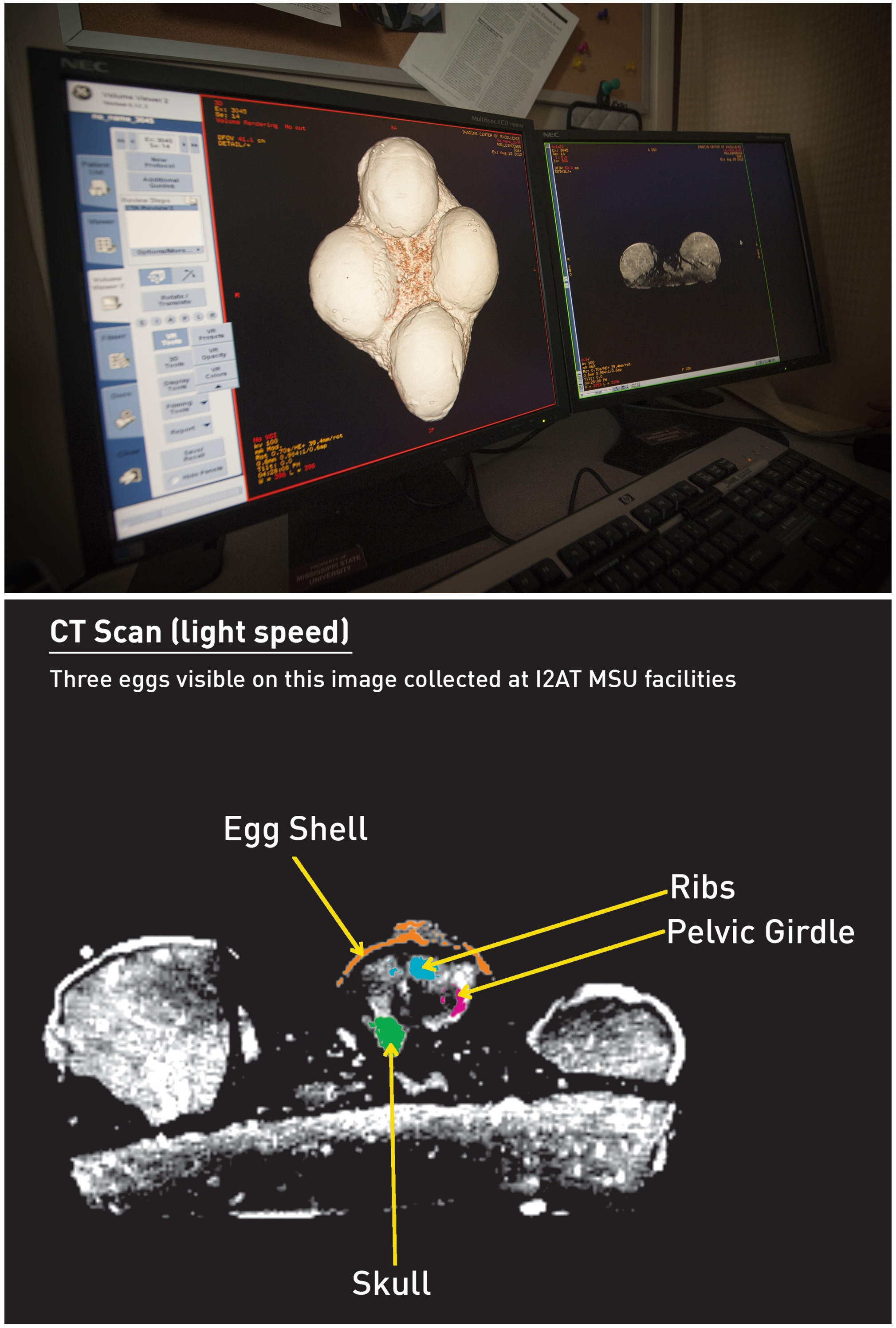 Top: Mississippi State's Institute for Imaging and Analytical Technologies, or I2AT, and Starkville-based Premier Imaging sponsored more than 10,000 X-rays of doctoral student John Paul Jones' dinosaur eggs in 2012. Bottom: At least one of the dinosaur eggs, highlighted, appears to be fully intact. In hopes of verifying genus and species, Jones has taken the eggs to Amgueddfa Cymru--National Museum Wales to learn more.